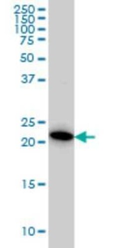 RAB38 Antibody (7F1), Novus Biologicals 0.1 mg | Buy Online | Novus Biologicals | Fisher Scientific
