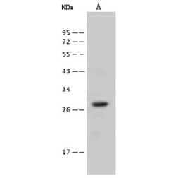 RAB38 Antibody, Novus Biologicals 100 &mu;g; Unconjugated:Antibodies, Polyclonal