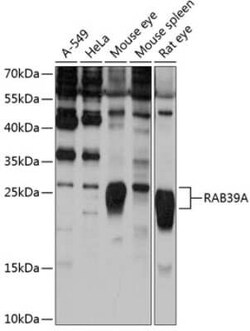RAB39 Antibody - Azide and BSA Free, Novus Biologicals 0.1 mL; Unconjugated:Antibodies,