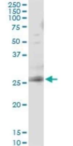 RAB3B Antibody (1A7), Novus Biologicals 0.1 mg | Buy Online | Novus Biologicals | Fisher Scientific