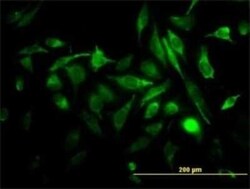 RAB3B Antibody (3F12), Novus Biologicals 0.1 mg | Buy Online | Novus Biologicals | Fisher Scientific