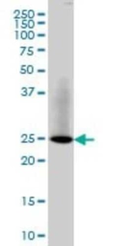 RAB3B Antibody (3F12), Novus Biologicals 0.1 mg | Buy Online | Novus Biologicals | Fisher Scientific