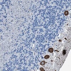 RAB3IL1 Antibody, Novus Biologicals 25 &mu;L | Buy Online | Novus Biologicals | Fisher Scientific