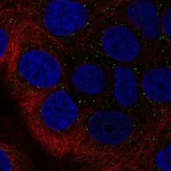 RAB40B Rabbit anti-Human, Polyclonal, Novus Biologicals 100 &mu;g | Buy Online | Novus Biologicals | Fisher Scientific