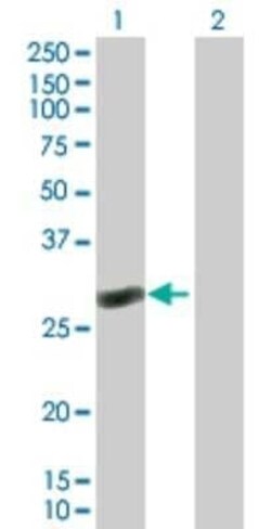 RAB40C Antibody, Novus Biologicals 0.05 mg | Buy Online | Novus Biologicals | Fisher Scientific