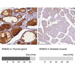 RAB43 Antibody, Novus Biologicals 25 &mu;L | Buy Online | Novus Biologicals | Fisher Scientific
