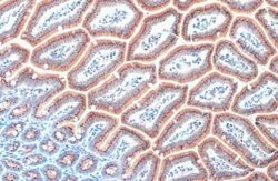 RAB6A Antibody (HL1047), Novus Biologicals 100 &mu;g | Buy Online | Novus Biologicals | Fisher Scientific