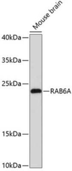 RAB6A Antibody - Azide and BSA Free, Novus Biologicals 0.1 mL; Unconjugated:Antibodies,