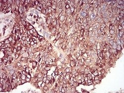 RAB6B Antibody (6D12E4) - BSA Free, Novus Biologicals:Antibodies:Primary