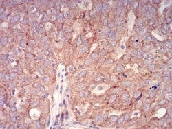 RAB6B Antibody (6D12E4) - BSA Free, Novus Biologicals:Antibodies:Primary