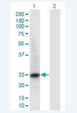 Novus Biologicals RAB6B Antibody (1A5), Novus Biologicals 100 &mu;g | Buy Online | Novus Biologicals&trade; | Fisher Scientific