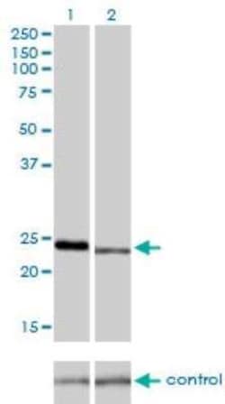 RAB7L1 Antibody (2B8), Novus Biologicals 0.1 mg | Buy Online | Novus Biologicals | Fisher Scientific