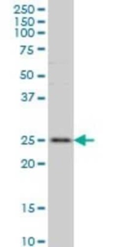 RAB7L1 Antibody (2B8), Novus Biologicals 0.1 mg | Buy Online | Novus Biologicals | Fisher Scientific