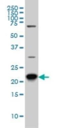RAB8A Antibody (3G1), Novus Biologicals 0.1 mg | Buy Online | Novus Biologicals | Fisher Scientific