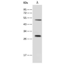 RAB8B Antibody, Novus Biologicals:Antibodies:Primary Antibodies