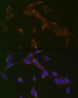 RAB9A Rabbit anti-Human, Mouse, Rat, Clone: 7O1G4, Novus Biologicals 20 &mu;g | Buy Online | Novus Biologicals | Fisher Scientific