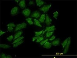 RAB9A Antibody (1E12), Novus Biologicals 0.1 mg | Buy Online | Novus Biologicals | Fisher Scientific