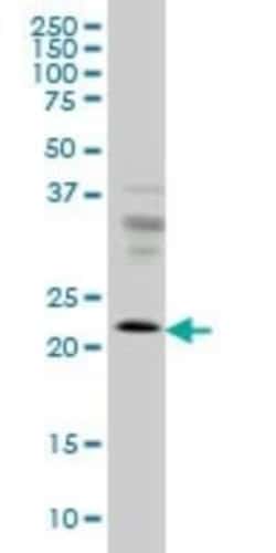 RAB9A Antibody (1E12), Novus Biologicals 0.1 mg | Buy Online | Novus Biologicals | Fisher Scientific