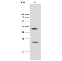 RAB9A Antibody, Novus Biologicals:Antibodies:Primary Antibodies