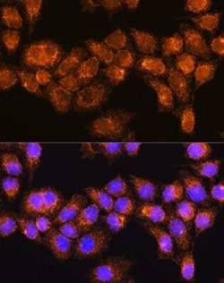 RABL3 Antibody - Azide and BSA Free, Novus Biologicals 0.1 mL, Unconjugated:Antibodies,