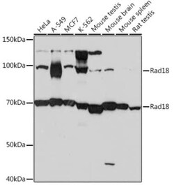RAD18 Rabbit anti-Human, Mouse, Rat, Clone: 9Y1H3, Novus Biologicals 100 &mu;g | Buy Online | Novus Biologicals | Fisher Scientific