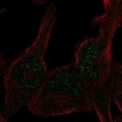 RAD26L Rabbit anti-Human, Polyclonal, Novus Biologicals 100 &mu;g | Buy Online | Novus Biologicals | Fisher Scientific