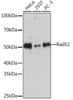 RAD52 Rabbit anti-Human, Clone: 7H5K0, Novus Biologicals 100 &mu;g | Buy Online | Novus Biologicals | Fisher Scientific