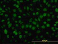 Novus Biologicals RAD54B Antibody (4A7), Novus Biologicals 0.1 mg | Buy Online | Novus Biologicals&trade; | Fisher Scientific