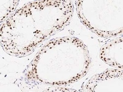 RAD54B Antibody, Novus Biologicals 50 &mu;g, Unconjugated:Antibodies, Polyclonal