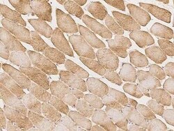 RAD9B Antibody, Novus Biologicals 100 &mu;g; Unconjugated:Antibodies, Polyclonal