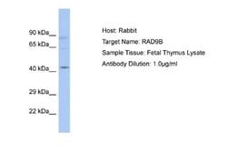 RAD9B Rabbit anti-Human, Polyclonal, Novus Biologicals 0.1ml; Unconjugated:Antibodies,