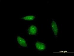 RAG2 Antibody, Novus Biologicals 0.05 mg | Buy Online | Novus Biologicals | Fisher Scientific