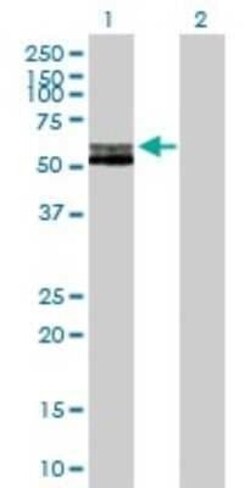 RAG2 Antibody, Novus Biologicals 0.05 mg | Buy Online | Novus Biologicals | Fisher Scientific
