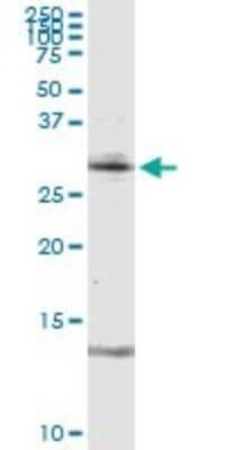RAG2 Antibody, Novus Biologicals 0.1 mg | Buy Online | Novus Biologicals | Fisher Scientific
