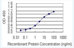 RAI1 Antibody (6H5), Novus Biologicals 100 &mu;g | Buy Online | Novus Biologicals | Fisher Scientific