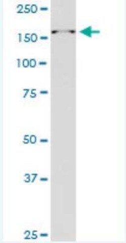 RAI1 Antibody (6H5), Novus Biologicals 100 &mu;g | Buy Online | Novus Biologicals | Fisher Scientific