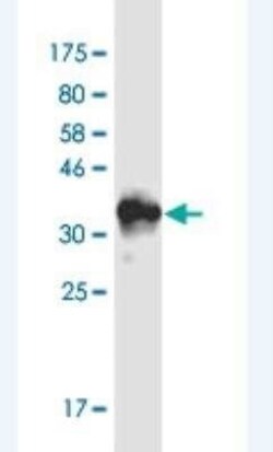 RAI1 Antibody (6H5), Novus Biologicals 100 &mu;g | Buy Online | Novus Biologicals | Fisher Scientific