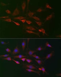 RAI16 Rabbit anti-Human, Mouse, Rat, Polyclonal, Novus Biologicals 100