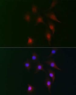 RAI16 Rabbit anti-Human, Mouse, Rat, Polyclonal, Novus Biologicals 100