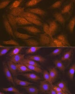 RAIDD/CRADD Rabbit anti-Human, Rat, Clone: 3Z9N8, Novus Biologicals:Antibodies:Primary