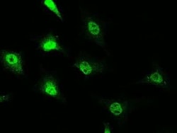 RAIDD/CRADD Antibody, Novus Biologicals 100 &mu;g; Unconjugated:Antibodies,