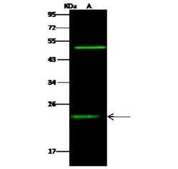 RAIDD/CRADD Antibody, Novus Biologicals 100 &mu;g; Unconjugated:Antibodies,