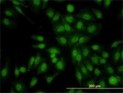 RALGPS2 Antibody (3F1), Novus Biologicals 0.1 mg | Buy Online | Novus Biologicals | Fisher Scientific