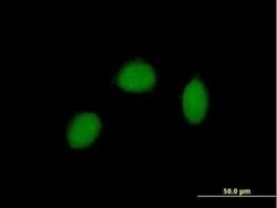 RALY Antibody, Novus Biologicals 0.05 mg | Buy Online | Novus Biologicals | Fisher Scientific