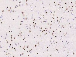 RALYL Antibody, Novus Biologicals:Antibodies:Primary Antibodies