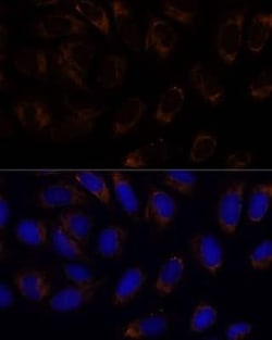 RAMP1 Antibody - BSA Free, Novus Biologicals:Antibodies:Primary Antibodies