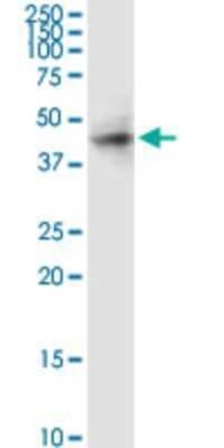 RAMP3 Antibody (1B4), Novus Biologicals 0.1 mg | Buy Online | Novus Biologicals | Fisher Scientific