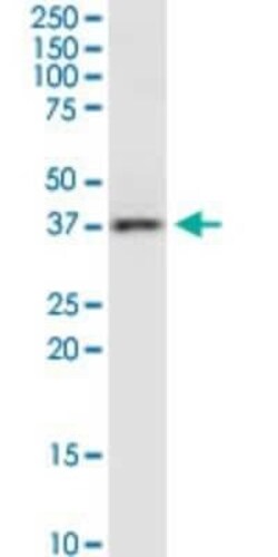 RAMP3 Antibody (1C11), Novus Biologicals 0.1 mg | Buy Online | Novus Biologicals | Fisher Scientific