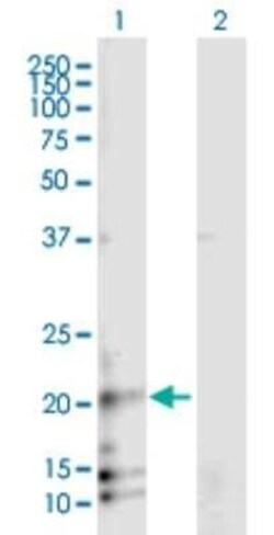 RAMP3 Antibody, Novus Biologicals™