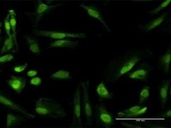 RANBP6 Antibody, Novus Biologicals 0.05 mg | Buy Online | Novus Biologicals | Fisher Scientific